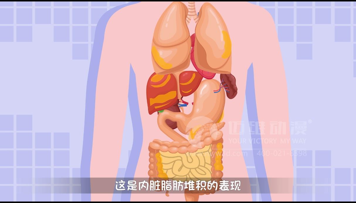 MG動畫，邁維動漫.jpg